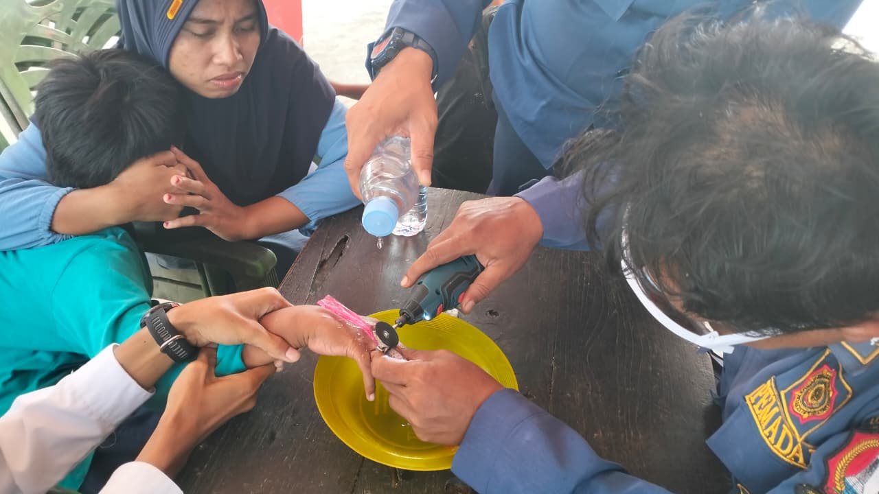 Damkarmat Bojonegoro Evakuasi Baut yang Terjepit pada Jari Anak di Pos Bantu Ngasem